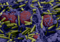 Biofilm de bactéries Pseudomonas aeruginosa formé dans un catheter central.