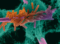 Interaction Aspergillus fumigatus et Pseudomonas aeruginosa, deux microorganismes du microbiote pulmonaire, observée en microscopie électronique à balayage