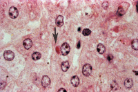 Inclusion du virus Ebola dans le cytoplasme des cellules du foie