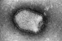 Virus de la rage en microscopie électronique