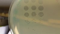 Exemple de plages de lyse d'un bactériophage infectant Escherichia coli