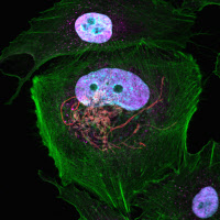 Réplication intracellulaire de Legionella pneumophila (en rouge) dans des cellules epithéliales de poumon 