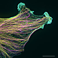 Cytosquelette d'un gliome en migration. 