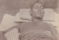 Malade la peste, Inde 1899