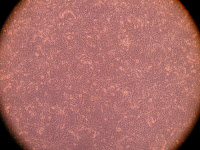 Cellules en culture infectées par le coronavirus MERS-CoV