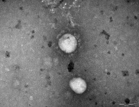 Coronavirus SARS-CoV en microscopie électronique à transmission