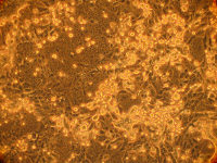 Culture de cellules infectées par le MERS-CoV