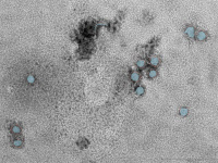 Coronavirus SARS-CoV en microscopie électronique à tranmission.