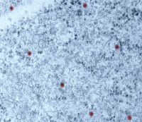 Cellules infectées par le virus du Zika en microscopie électronique à transmission