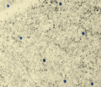 Cellules de singe vert infectées par le virus du Zika en microscopie électronique à transmission
