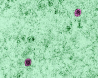 Cellules infectées par le virus du Zika en microscopie électronique à transmission.