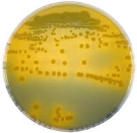 Colonies de Vibrio cholerae sur un milieu sélectif TCBS