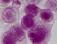 Cellules infectées par Chlamydia trachomatis, après deux jours de culture
