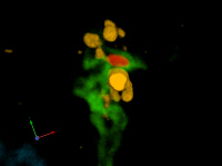 Shigella flexneri infectant une cellule Hela