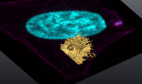 Foyer d’infection de Shigella flexneri sur une cellule Hela