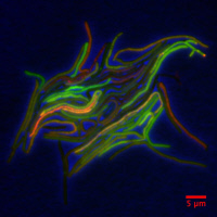 Mycobacterium smegmatis, modèle non pathogène pour la tuberculose, vues en fluorescence (vert et rouge) et contraste de phase (bleu) fusionnées.