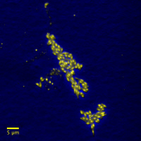 Images de Mycobacterium smegmatis, modèle non pathogène pour la tuberculose, vues en fluorescence (jaune) et contraste de phase (bleu) fusionnées.