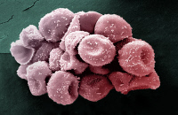 Grains de pollen de cyprès (Hesperocyparis arizonica) observés en microscopie électronique à balayage