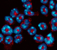 Neutrophiles dont le noyau multilobé est coloré en bleu. En rouge, la myéloperoxidase (MPO)