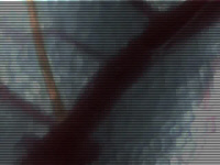 Piqure d'Aedes albopictus vue en vidéomicroscopie
