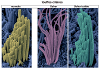 Touffes ciliaires de cellules sensorielles vestibulaires