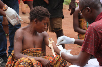 Monkeypox virus in Central African Republic.