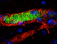 Micro-vaisseau sanguin humain colonisé par Neisseria meningitidis.