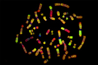 Hybridation génomique comparative de carcinomes hépatocellulaires sur plaques métaphasiques