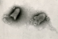 Virus de la rage en microscopie électronique