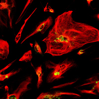 Astrocytes infectées avec le virus de la rage