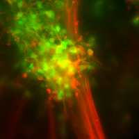 Neurones infectés avec le virus de la rage