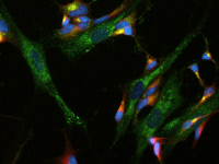 Cellules neuronales humaines infectées par le virus West Nile