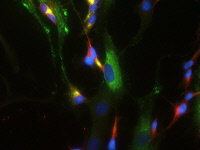 Cellules neuronales humaines infectées par le virus West Nile