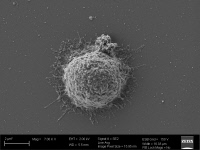 Biofilm viral produit par un lymphocyte T de patient infecté par le VIH-1, visualisé  par microscopie électronique à balayage