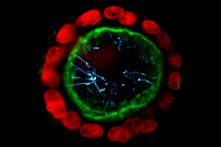 Sphéroïde de cellules rénales cultivées in vitro