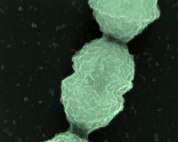 Streptococcus agalactiae en microscopie electronique à balayage