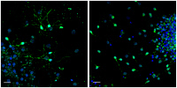 Neurogenèse induite par supplémentation de GDF11 dans le sang âgé