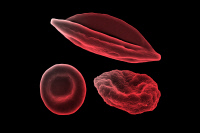 Globules rouges et infection par Plasmodium falciparum