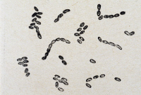 Cocco-bacilles de la peste, dessin, 1909
