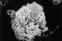 Mycoplasmes à la surface d'un lymphocyte