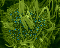 Cellule ciliée infectée par le SARS-CoV-2