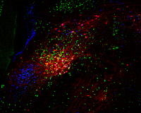 Neurones du noyau parabrachial contrôlant la réponse hormonale.
