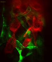 Cellules de glioblastomes in vivo