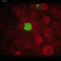 Imagerie en temps réel de la transmission du VIH-1 de cellule à cellule.