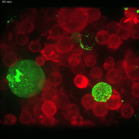Imagerie en temps réel de la transmission du VIH-1 de cellule à cellule