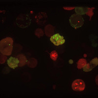Imagerie en temps réel de la transmission du VIH-1 de cellule à cellule.