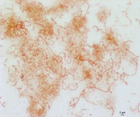 Ruminococcus torques group en microscopie optique