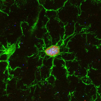 Cellule microgliale en voie de mort cellulaire suite à chimiothérapie