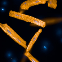 Cardiomyocytes de souris (orange) et mitochondries (bleu)