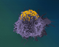 Accumulation de particules de VIH à la surface d’une cellule infectée